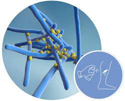 We did not find results for: Products For Wound Infections Belano Medical Ag