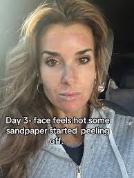 How Long Does It Take to Cover from Co2 Laser