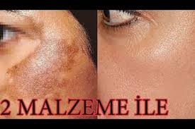 15 Dakika Da Leke Giderici Sikilastirici Kirisik Acici Dogal Maske Tarif I Verdim Bunu Yaparak Guzellik Bakim Ve Cilt Baki Maskeler Cilt Tedavileri Cilt Bakimi