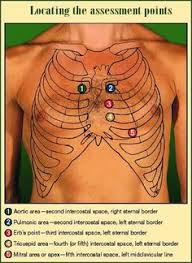 The apgar score is a method to quickly summarize the health of newborn children against infant mortality. 5 Auscultation Points Of The Heart