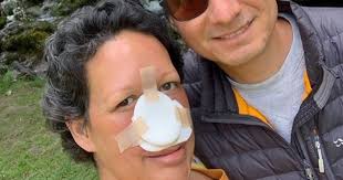 The stages of nasal cavity and paranasal sinus cancers are slightly different, based on where the cancer starts. Aggressive Cancer Forced Mom To Have Nose Removed Survivornet