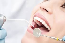 Diş Dolgu Tedavisi - Sadabad Diş Kliniği