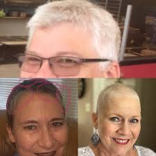 Margo's Plasmacytoid Bladder Cancer Story