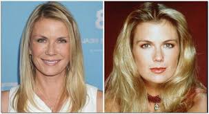 Katherine Kelly Lang Plastic Surgery Before After Katherine Kelly Cosmetic Surgery Plastic Surgery