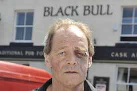 Battered landlord relives pub raid attack horror