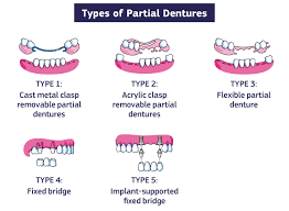 Image result for dentures