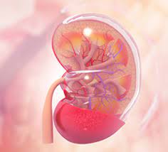 Acquired 5.2 imaging investigations most renal tumours are diagnosed by abdominal us or ct performed for. End Stage Kidney Disease Treatment In India Dialysis For Kidney Failure
