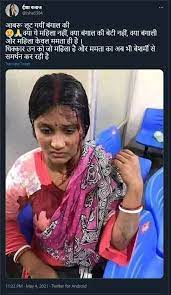 Jun 14, 2021 · a rare picture of shah rukh khan in his young days has been going viral on the internet. Old Photo Of Injured Bangladeshi Woman Peddled As Wb Post Poll Violence