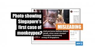 A congo basin country), disease in the usa appeared milder. This Is Not A Photo Of A Nigerian Man Diagnosed With Monkeypox In Singapore In May 2019 It S An Old Image Of A Congo Child With The Disease Fact Check