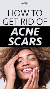 Expert Philip Belcher of Bellmans introduces you to the fascinating world  of the pocket watch. #saleroom #thesaleroom #fineart #secondhand  #second-hand #luxury #pocketwatches #pocketwatch #watch #watches