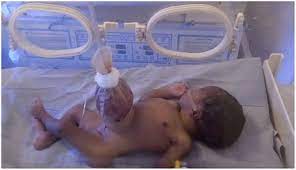 Silo, the comprehensive digital asset management system offers a complete technology stack for the management of cryptocurrencies and tokens. Frontiers Challenges And Outcome Of Management Of Gastroschisis At A Tertiary Institution In North Eastern Nigeria Surgery