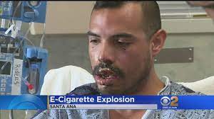 A vape pen exploded, here is what happened to the teen. Pin On E Cig Explosion Injuries