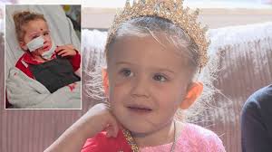 Pageant win for Doncaster girl, 4, left scarred by dog bite