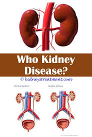 Kidney Disease Articles Polycystic Kidney Disease Causes Of Kidney Disease Kidney Disease Stages