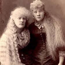 Barnum Bailey Albino Martin Sisters Human Oddities Vintage Photos Long Hair Styles