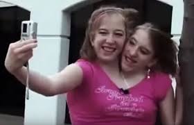 Abigail abby loraine hensel and brittany britty lee hensel (born march 7, 1990) are dicephalic parapagus twins, meaning that they are conjoined twins of whom each has a separate head, but whose bodies are joined. 30 Interesting Things About Famous Conjoined Twins Abby And Brittany Hensel