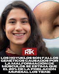 Sabías que uno de los rasgos más adorados de una sonrisa es, en realidad,  un pequeño "error" de la naturaleza? Lo que comúnmente llamamos hoyuelos  tiene un origen científico que te sorprenderá.