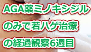 「"新しいコメントをメールで通知" depigmentation」の画像検索結果