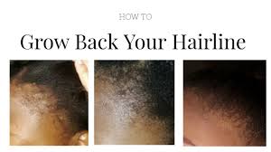 We did not find results for: How To Grow Back Your Hairline South African Youtuber Youtube