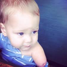 Amniotic Band Syndrome Support Page