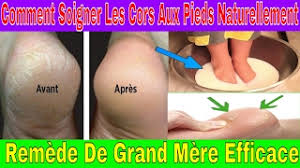 Il se situe généralement au niveau des zones de frottements, sur le dessus, les côtés ou entre deux orteils. Comment Soigner Les Cors Aux Pieds Naturellement Remede De Grand Mere Youtube
