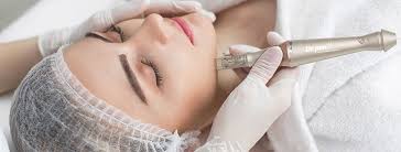 Are Microneedling Pens Safe? Unveiling the Truth and Unlocking Radiant Skin  - BYALL