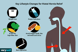 In this case, the junction of the oesophagus and stomach stays down within the abdomen, and the top part of the stomach (the fundus) bulges up into the chest cavity. How A Hiatal Hernia Is Treated