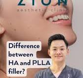 What’s the difference between hyaluronic acid (HA) and PLLA fillers? 🎥  Listen as Dr Ng breaks it down and explains the key differences., Spoiler  alert: Both have their own unique benefits — and Dr Ng ...