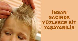 Sac Biti Ve Sirke Nasil Temizlenir