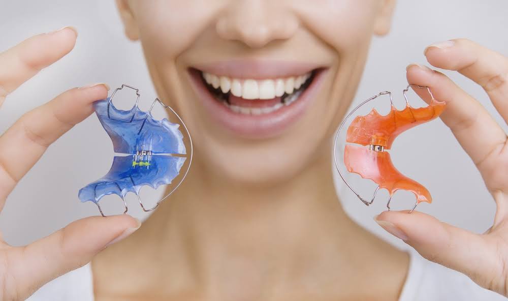 Retainers product image