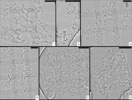 What is the latin word for eyelash and why is this relevant to the histology of the lung? 3d Virtual Pathohistology Of Lung Tissue From Covid 19 Patients Based On Phase Contrast X Ray Tomography Elife