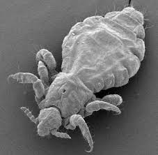 Lice Much Like Fleas In Terms Of How It Lives These Insects Live On Peoples Scalp Making Them Have An Itchy Head They Are Very Head Louse Louse Itchy Head