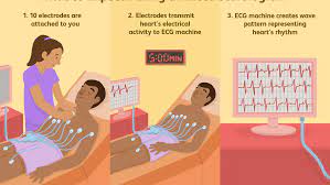 Maybe you would like to learn more about one of these? Electrocardiogram Ecg Or Ekg Procedure And Results