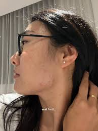 Cutting Out Sugar Skin