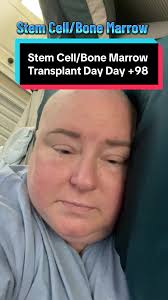 Día +98 de Trasplante de Células Madre