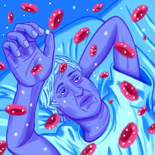 Image result for Anemia