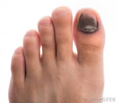 Here are 13 benefits of using these oils Prepper Foot Care
