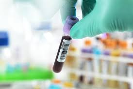 Covid 19 Swab Testing In Primary Care Is Next Step Says Nhs England Gponline