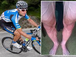 Pawel poljanski showed the world what kind of toll the famed tour de france can take on the human body, and the photo he posted of his legs sent the internet. You Re So Vein Tour De France Rider Bartosz Huzarski Posts Disturbing Picture Of His Legs Mirror Online