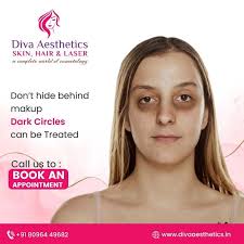 It's important to remember that you shouldn't hide behind makeup. If you  have dark circles, there are treatments available that can help. Book your  Appointment call us: 8096449682 #skinclinic #prptreatment #hairloss  #hairlosstreatment #
