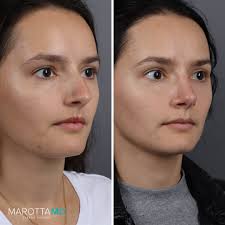 Marotta Plastic Surgery Specialists