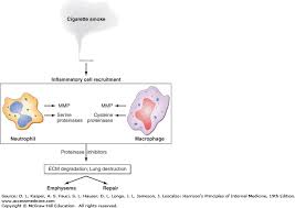 chronic obstructive pulmonary disease harrisons