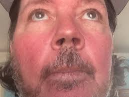 Fundraiser for Patrick Gushue by Brian Gushue : Pat's dental work