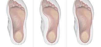 Arch Foot Types Chart Mens Walking Shoes Best Walking Shoes Walking Boots