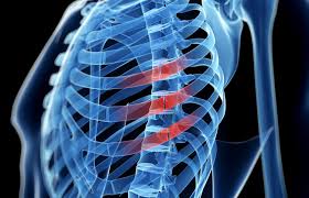 Take A Fall Here S How To Tell You Might Have A Broken Rib