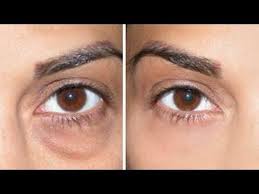 Pin On Healthy Natural Beauty Tips Trucos Saludables De Belleza Beaute Sante Naturelle