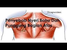 Untuk mengetahui lebih lanjut akan punca yang menyebabkan sakit bahu. Penyebab Nyeri Bahu Dan Punggung Bagian Atas Youtube