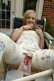 Full Body Plaster Cast Porn Sex Pictures Pass 6210 | Hot Sex Picture