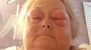 Fundraiser by Sherri Meadows : Donate to Becky Pike's Healing and Support