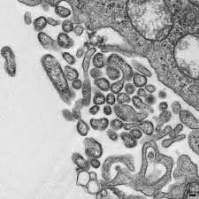 Each virus is usually associated with a particular rodent host species in which it is maintained. Arenaviridae An Overview Sciencedirect Topics